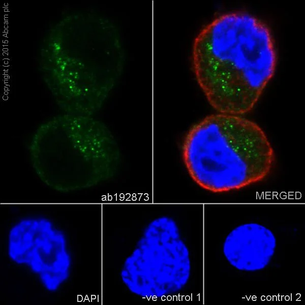 Immunocytochemistry/ Immunofluorescence - Anti-Solo antibody [EPR13772-74] (AB192873)
