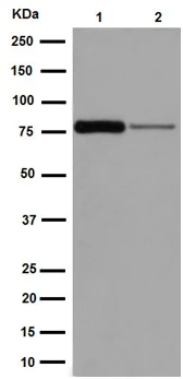 Western blot - Anti-Solo antibody [EPR13772-74] (AB192873)