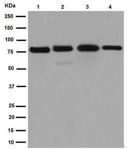 Western blot - Anti-Solo antibody [EPR13772-74] (AB192873)