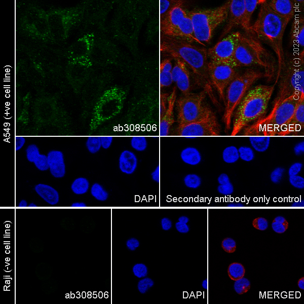 Immunocytochemistry/ Immunofluorescence - Anti-Soluble TNF Receptor I + Fc Fragment antibody [EPR26198-14] (AB308506), expandable thumbnail
