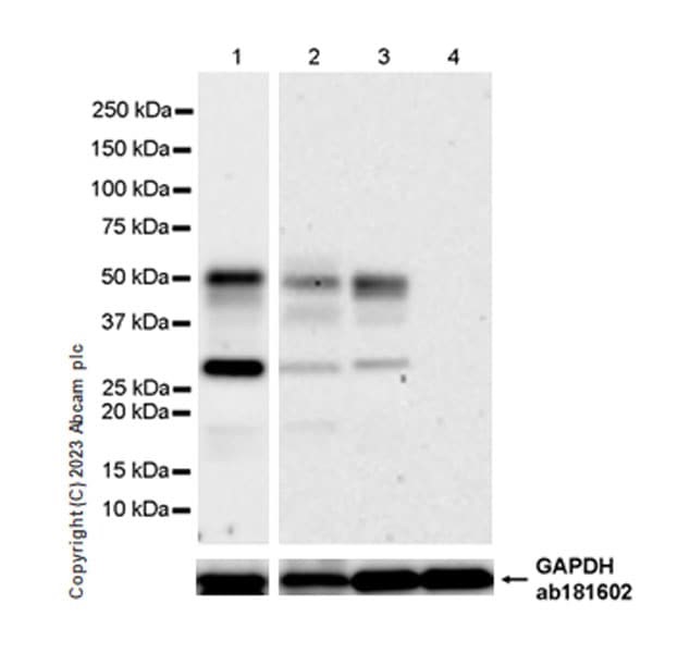 Western blot - Anti-Soluble TNF Receptor I + Fc Fragment antibody [EPR26198-14] (AB308506), expandable thumbnail