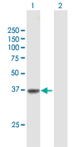 Western blot - Anti-Solute carrier family 22 member 18 antibody (AB168960), expandable thumbnail