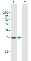 Western blot - Anti-Solute carrier family 22 member 18 antibody (AB168960)