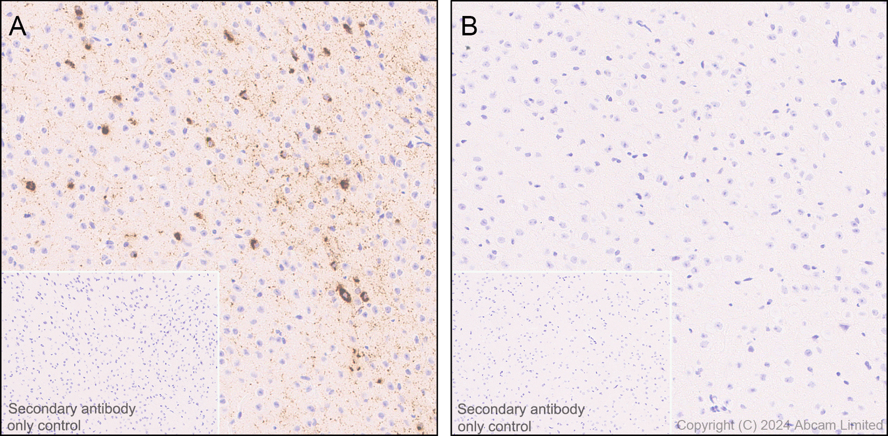 Immunohistochemistry (Formalin/PFA-fixed paraffin-embedded sections) - Anti-Somatostatin 28 antibody [EPR3359(2)] (ab111912), expandable thumbnail