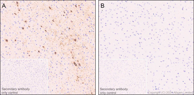 Immunohistochemistry (Formalin/PFA-fixed paraffin-embedded sections) - Anti-Somatostatin 28 antibody [EPR3359(2)] (AB111912)