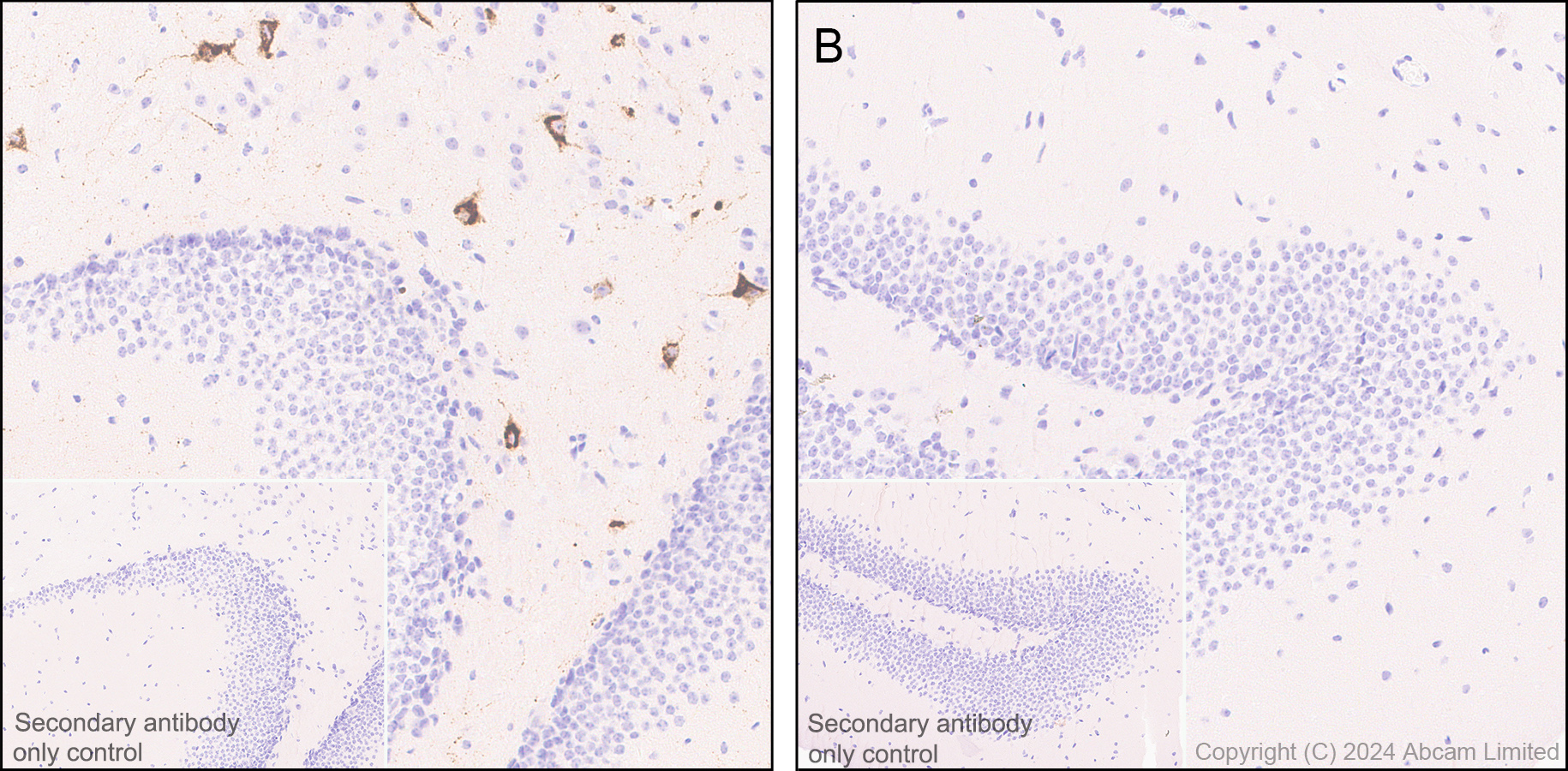 Immunohistochemistry (Formalin/PFA-fixed paraffin-embedded sections) - Anti-Somatostatin 28 antibody [EPR3359(2)] (ab111912), expandable thumbnail