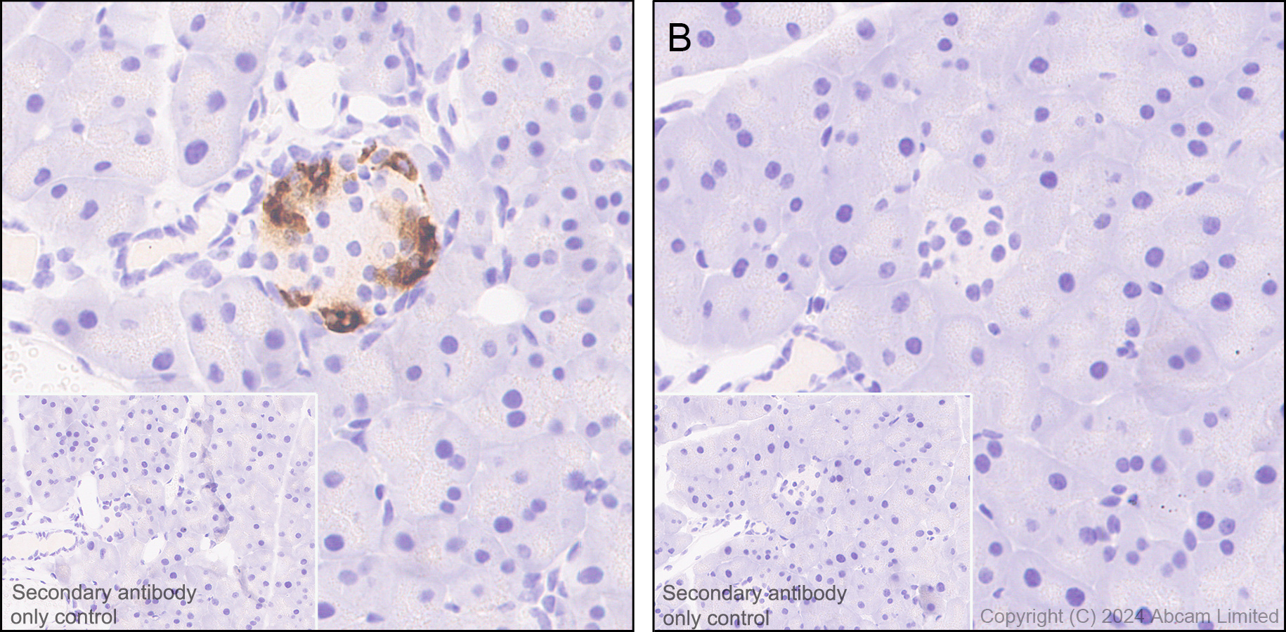 Immunohistochemistry (Formalin/PFA-fixed paraffin-embedded sections) - Anti-Somatostatin 28 antibody [EPR3359(2)] (ab111912), expandable thumbnail