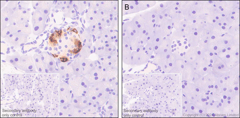 Immunohistochemistry (Formalin/PFA-fixed paraffin-embedded sections) - Anti-Somatostatin 28 antibody [EPR3359(2)] (AB111912)
