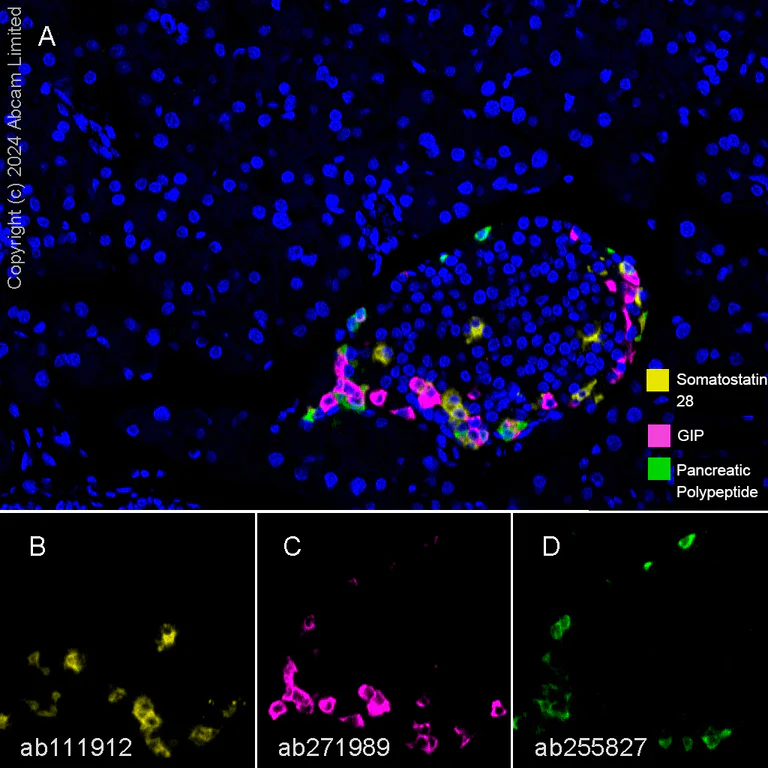Multiplex immunohistochemistry - Anti-Somatostatin 28 antibody [EPR3359(2)] (AB111912)