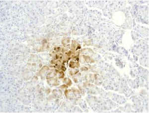 Immunohistochemistry (Formalin/PFA-fixed paraffin-embedded sections) - Anti-Somatostatin 28 antibody [EPR3360(2)] (AB111050)