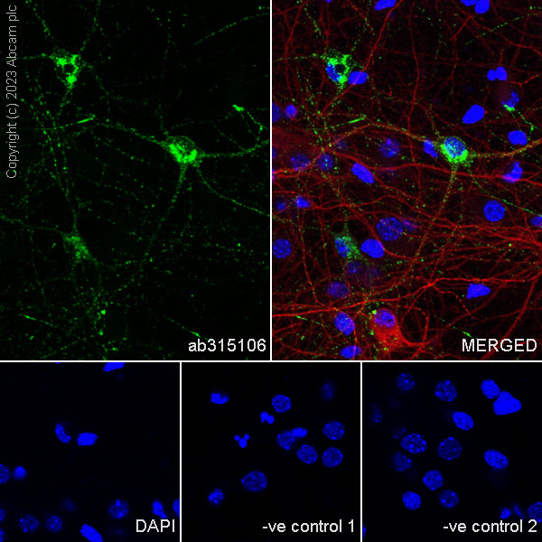 Immunocytochemistry/ Immunofluorescence - Anti-Somatostatin 28 antibody [RM1087] - BSA and Azide free (ab315107), expandable thumbnail