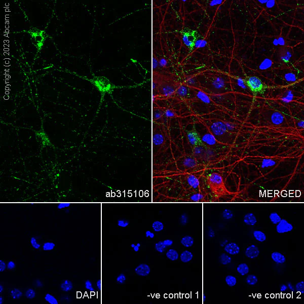 Immunocytochemistry/ Immunofluorescence - Anti-Somatostatin 28 antibody [RM1087] - BSA and Azide free (AB315107)