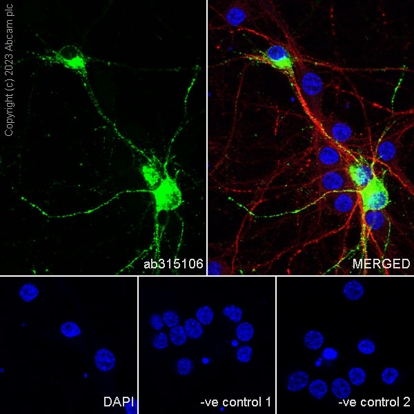 Immunocytochemistry/ Immunofluorescence - Anti-Somatostatin 28 antibody [RM1087] - BSA and Azide free (ab315107), expandable thumbnail