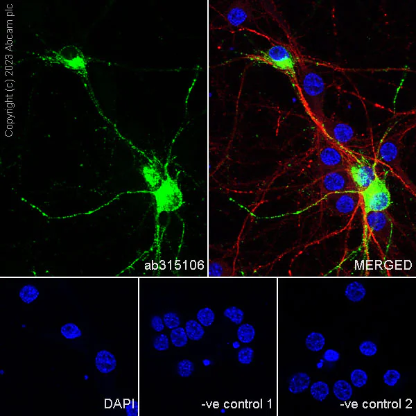 Immunocytochemistry/ Immunofluorescence - Anti-Somatostatin 28 antibody [RM1087] - BSA and Azide free (AB315107)