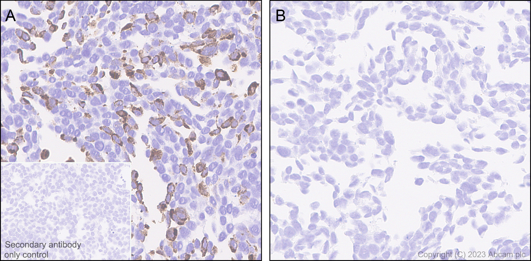 Immunohistochemistry (Formalin/PFA-fixed paraffin-embedded sections) - Anti-Somatostatin 28 antibody [RM1087] - BSA and Azide free (ab315107), expandable thumbnail