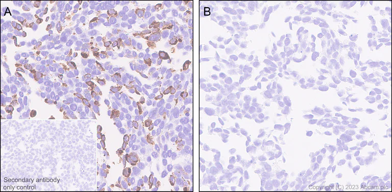 Immunohistochemistry (Formalin/PFA-fixed paraffin-embedded sections) - Anti-Somatostatin 28 antibody [RM1087] - BSA and Azide free (AB315107)