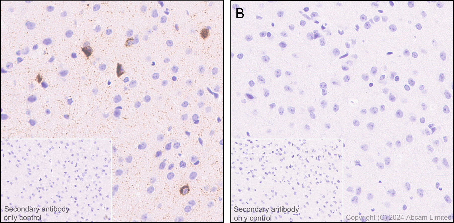 Immunohistochemistry (Formalin/PFA-fixed paraffin-embedded sections) - Anti-Somatostatin 28 antibody [RM1087] - BSA and Azide free (AB315107), expandable thumbnail