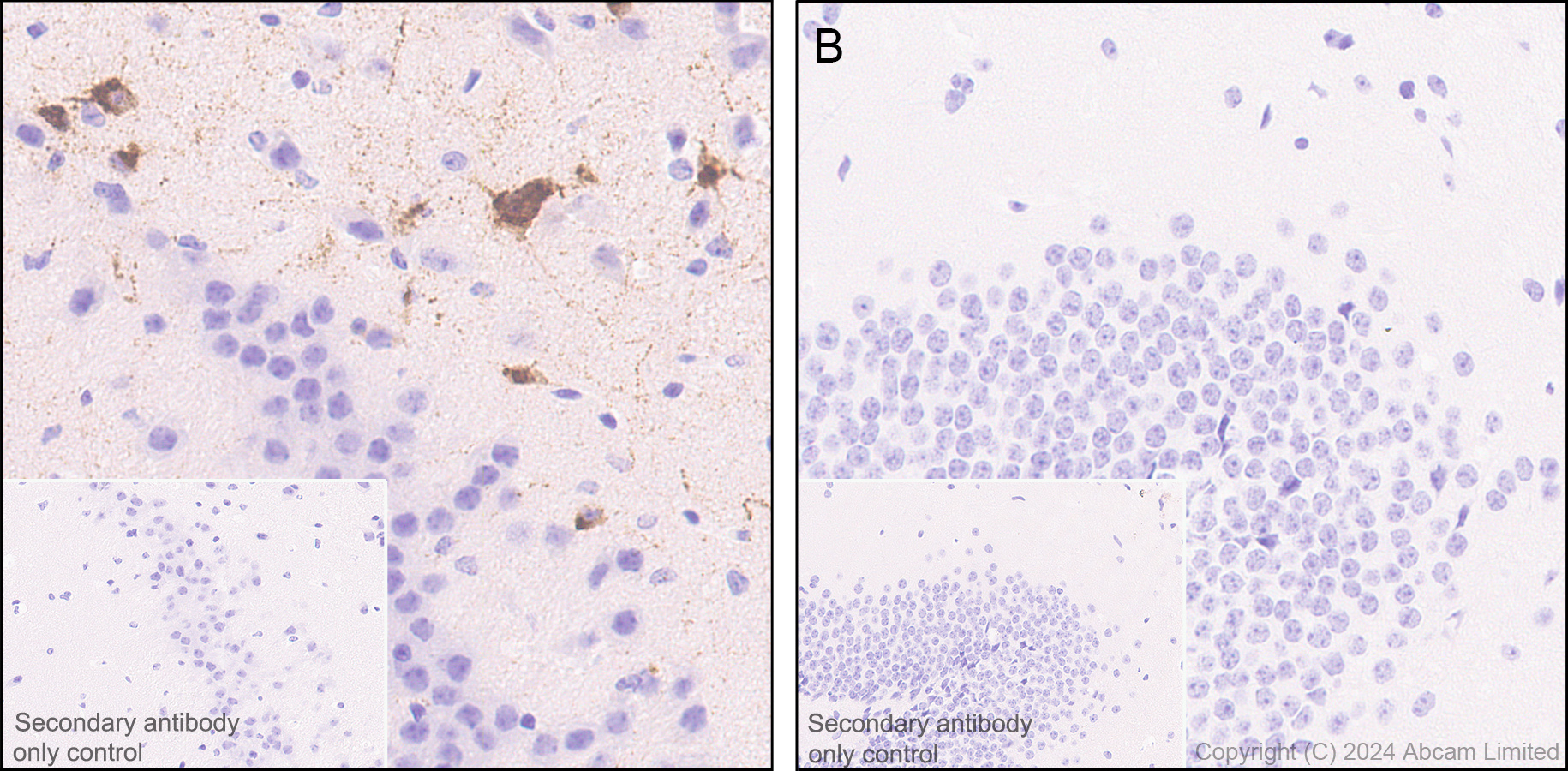 Immunohistochemistry (Formalin/PFA-fixed paraffin-embedded sections) - Anti-Somatostatin 28 antibody [RM1087] - BSA and Azide free (AB315107), expandable thumbnail
