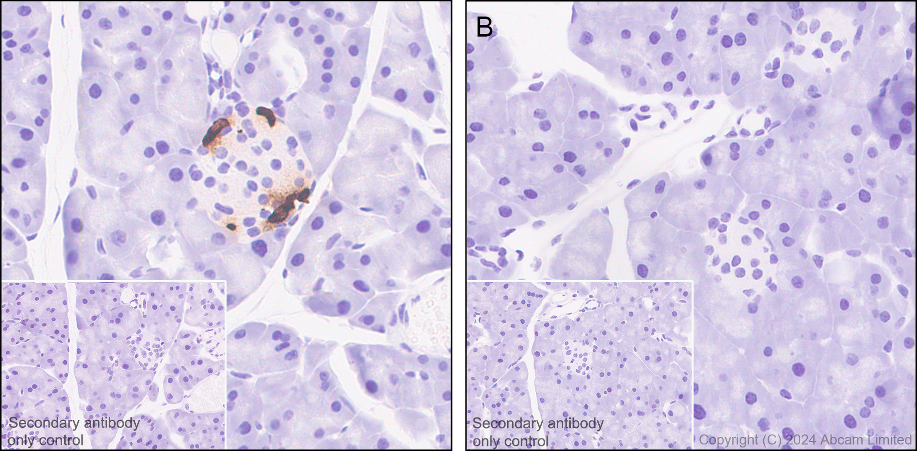 Immunohistochemistry (Formalin/PFA-fixed paraffin-embedded sections) - Anti-Somatostatin 28 antibody [RM1087] - BSA and Azide free (AB315107), expandable thumbnail