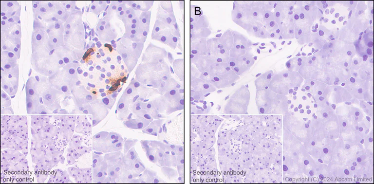 Immunohistochemistry (Formalin/PFA-fixed paraffin-embedded sections) - Anti-Somatostatin 28 antibody [RM1087] - BSA and Azide free (AB315107)