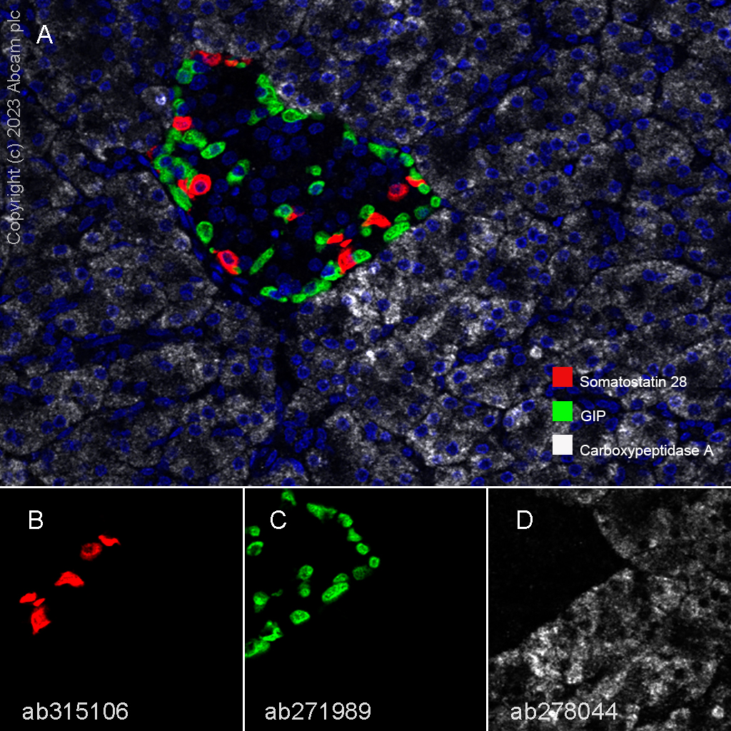 Multiplex immunohistochemistry - Anti-Somatostatin 28 antibody [RM1087] - BSA and Azide free (ab315107), expandable thumbnail