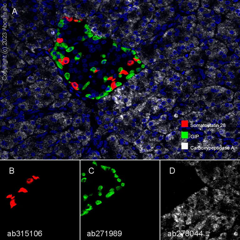 Multiplex immunohistochemistry - Anti-Somatostatin 28 antibody [RM1087] - BSA and Azide free (AB315107)