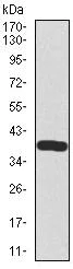 Western blot - Anti-Somatostatin antibody [7G5] (AB140665)