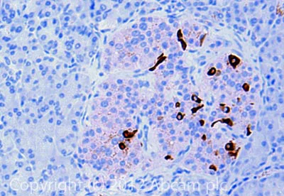 Immunohistochemistry (Formalin/PFA-fixed paraffin-embedded sections) - Anti-Somatostatin antibody (AB108456)