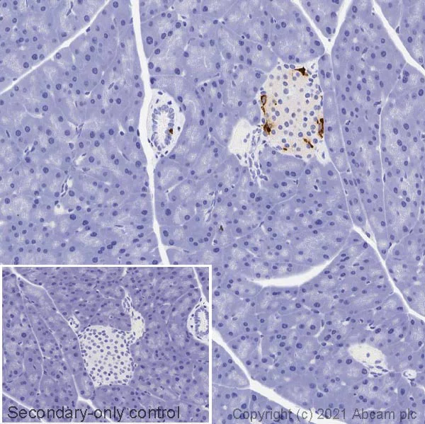 Immunohistochemistry (Formalin/PFA-fixed paraffin-embedded sections) - Anti-Somatostatin antibody (AB108456)