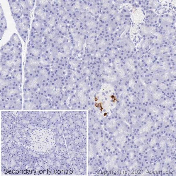 Immunohistochemistry (Formalin/PFA-fixed paraffin-embedded sections) - Anti-Somatostatin antibody (AB108456)