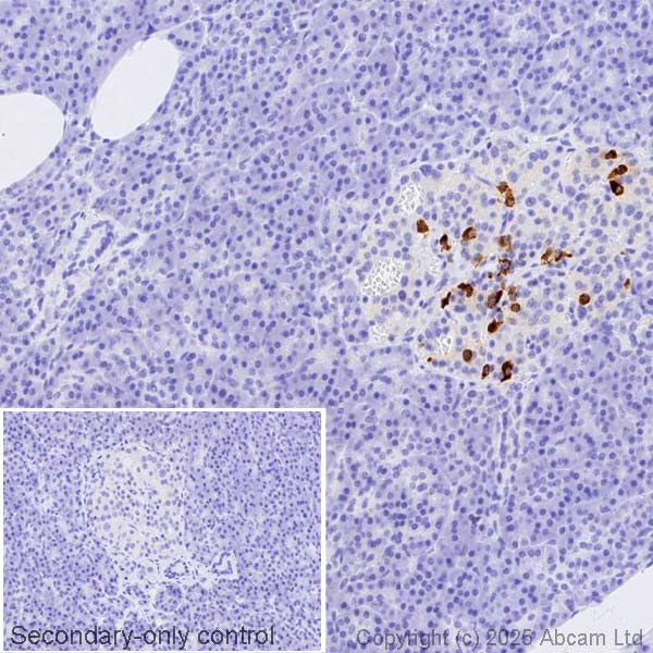 Immunohistochemistry (Formalin/PFA-fixed paraffin-embedded sections) - Anti-Somatostatin antibody [EPR28867-88] (AB323915), expandable thumbnail