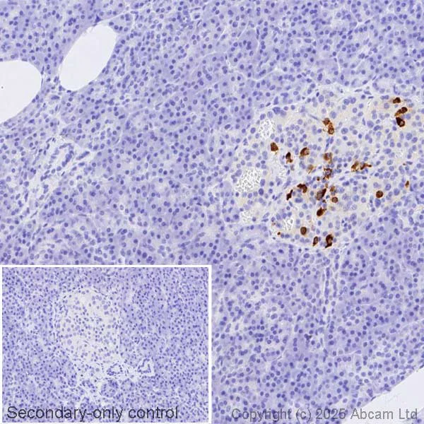 Immunohistochemistry (Formalin/PFA-fixed paraffin-embedded sections) - Anti-Somatostatin antibody [EPR28867-88] (AB323915)