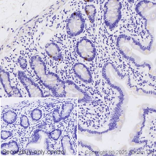 Immunohistochemistry (Formalin/PFA-fixed paraffin-embedded sections) - Anti-Somatostatin antibody [EPR28867-88] (AB323915), expandable thumbnail
