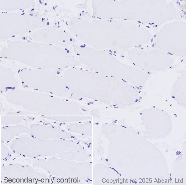 Immunohistochemistry (Formalin/PFA-fixed paraffin-embedded sections) - Anti-Somatostatin antibody [EPR28867-88] (AB323915), expandable thumbnail