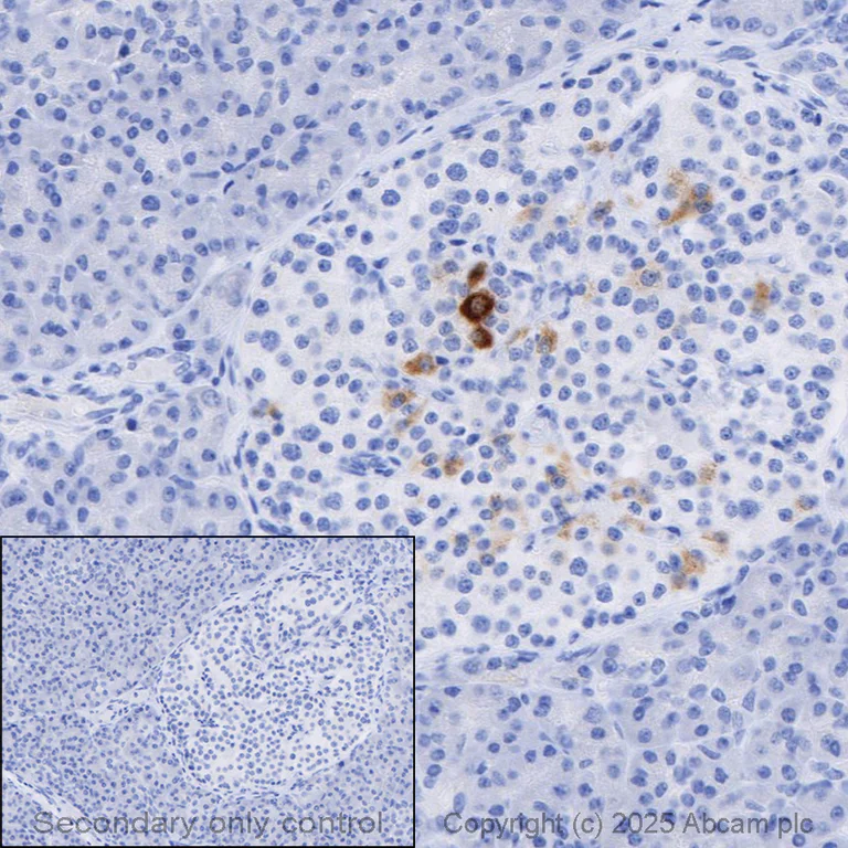 Immunohistochemistry (Formalin/PFA-fixed paraffin-embedded sections) - Anti-Somatostatin antibody [EPR28867-88] (AB323915)