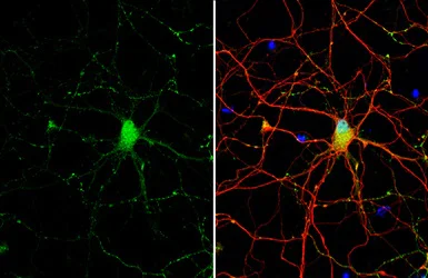 Immunocytochemistry/ Immunofluorescence - Anti-Somatostatin antibody [HL1101] (AB307803)