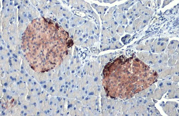 Immunohistochemistry - Anti-Somatostatin antibody [HL1101] (AB307803)