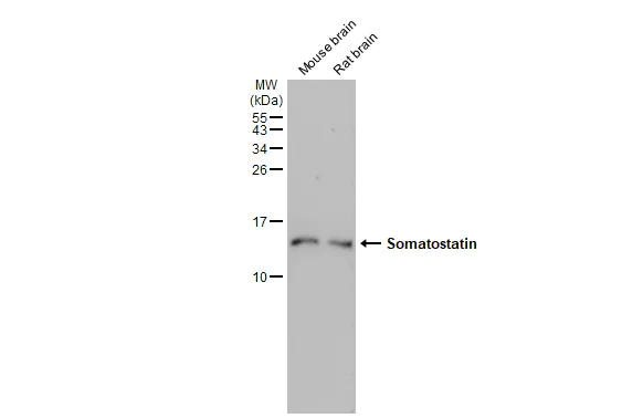 Western blot - Anti-Somatostatin antibody [HL1101] (AB307803)