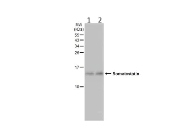 Western blot - Anti-Somatostatin antibody [HL1101] (AB307803)
