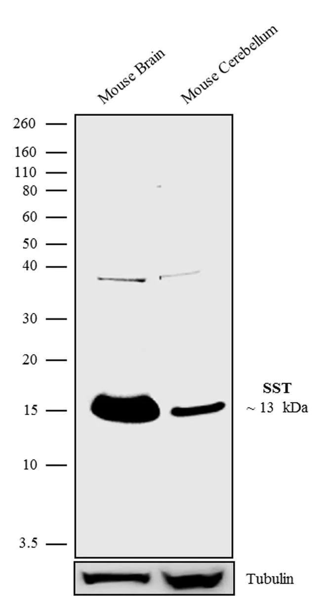 Western blot - Anti-Somatostatin Antibody [RP23040131] (AB313450)
