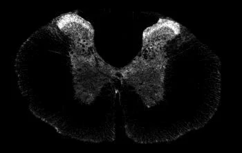 Immunocytochemistry/ Immunofluorescence - Anti-Somatostatin Receptor 1/SSTR1 antibody (AB100881)