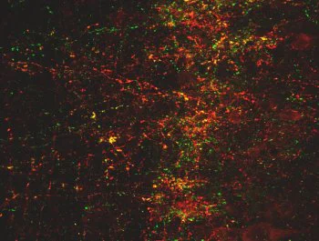 Immunocytochemistry/ Immunofluorescence - Anti-Somatostatin Receptor 1/SSTR1 antibody (AB100881)