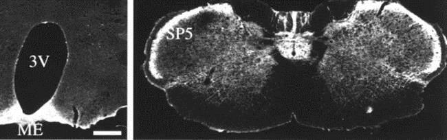 Immunocytochemistry/ Immunofluorescence - Anti-Somatostatin Receptor 1/SSTR1 antibody (AB100881)