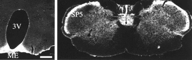 Immunocytochemistry/ Immunofluorescence - Anti-Somatostatin Receptor 1/SSTR1 antibody (AB100881)