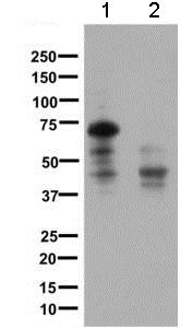 Western blot - Anti-Somatostatin Receptor 1/SSTR1 antibody [UMB7] (AB137083), expandable thumbnail