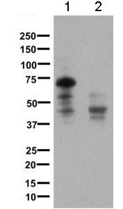 Western blot - Anti-Somatostatin Receptor 1/SSTR1 antibody [UMB7] (AB137083)