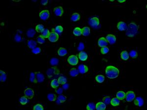 Immunocytochemistry/ Immunofluorescence - Anti-Somatostatin Receptor 1/SSTR1 antibody [UMB7] - BSA and Azide free (AB240103), expandable thumbnail