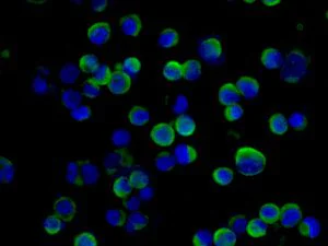 Immunocytochemistry/ Immunofluorescence - Anti-Somatostatin Receptor 1/SSTR1 antibody [UMB7] - BSA and Azide free (AB240103)