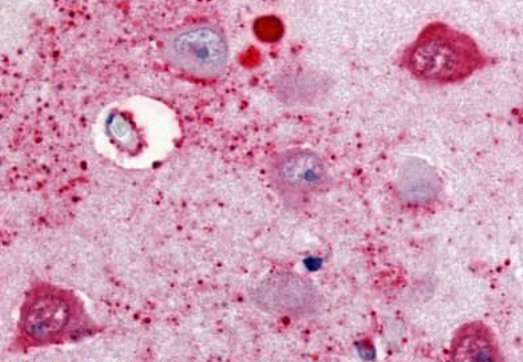 Immunohistochemistry (Formalin/PFA-fixed paraffin-embedded sections) - Anti-Somatostatin Receptor 2 antibody - Cytoplasmic domain (AB189080)