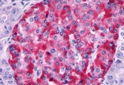 Immunohistochemistry (Formalin/PFA-fixed paraffin-embedded sections) - Anti-Somatostatin Receptor 2 antibody - Extracellular domain (AB140933)